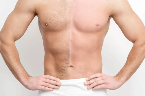 Chest hair removal